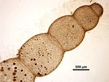 7 – Porzione apicale di una ramificazione laterale con tetrasporocisti negli articoli subapicali
